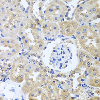 ITPKB Antibody