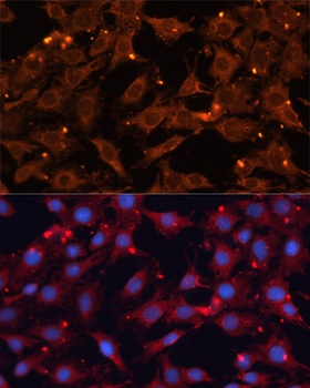 INPP5B Antibody