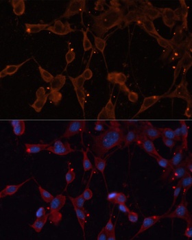 INPP5B Antibody