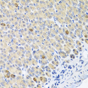 GLS Antibody