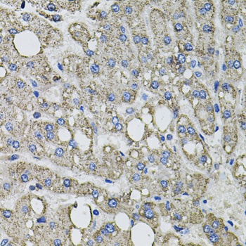 GFPT1 Antibody