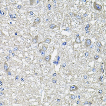 GFPT1 Antibody