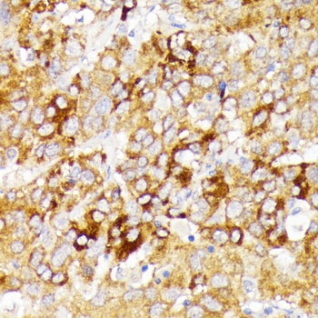 GALC Antibody