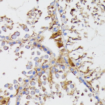 GALC Antibody