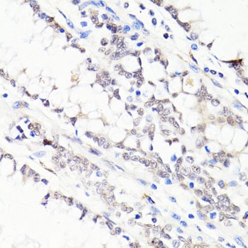 FKBP5 Antibody