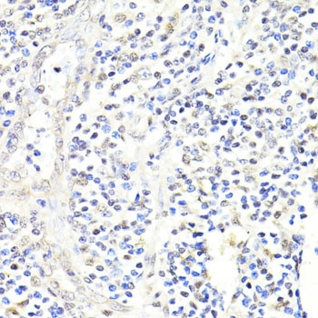 FKBP5 Antibody