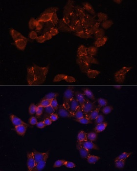 FKBP5 Antibody