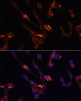 FKBP5 Antibody