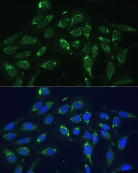 FKBP5 Antibody