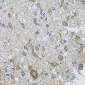 DYNC1I1 Antibody