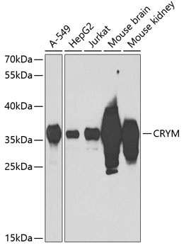 CRYM Antibody