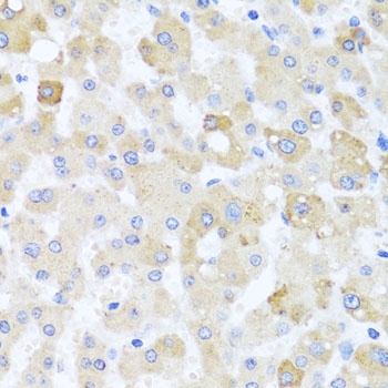 CETN1 Antibody