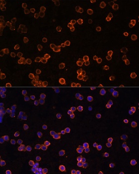 ENTPD1 Antibody