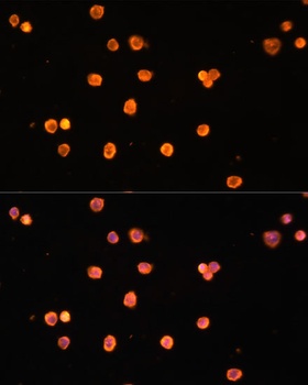 ENTPD1 Antibody