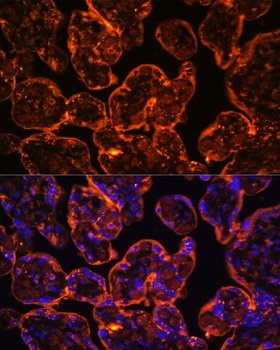 ENTPD1 Antibody