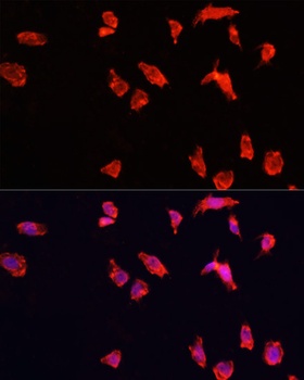 ATP6V1B2 Antibody
