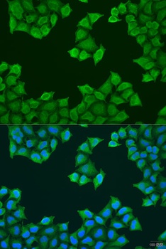 ATP5J Antibody