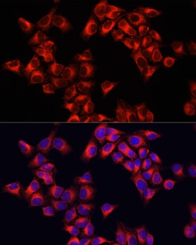 ARHGAP1 Antibody