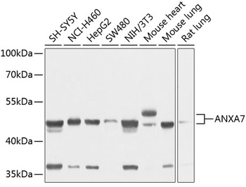 ANXA7 Antibody