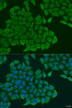 ANXA7 Antibody