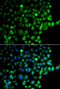 RAB31 Antibody