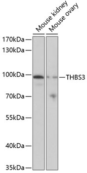 THBS3 Antibody