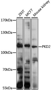 PKD2 Antibody