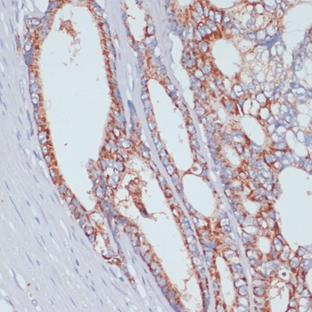 SLC39A4 Antibody