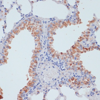 SLC39A4 Antibody