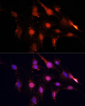 NSUN2 Antibody