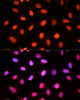 NSUN2 Antibody