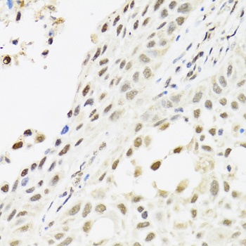 C14orf166 Antibody