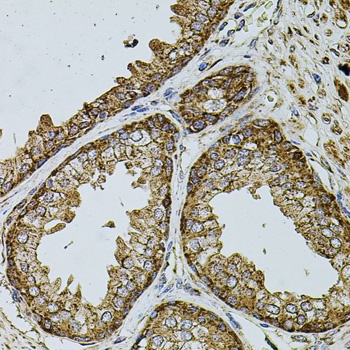 UQCRC1 Antibody