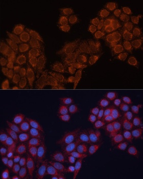 ALDH6A1 Antibody