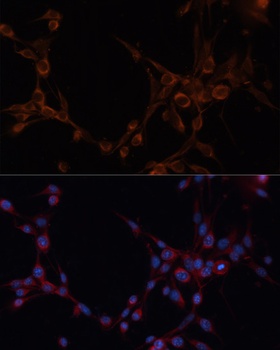 ALDH6A1 Antibody