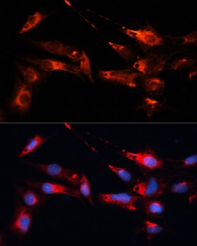 MAP1B Antibody