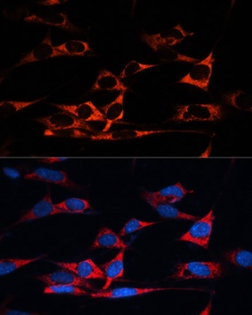 MAP1B Antibody