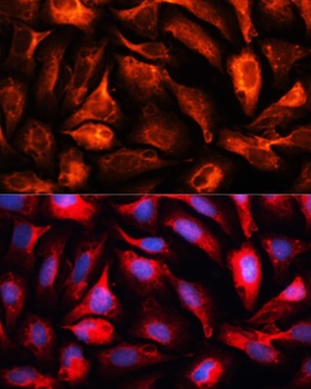 MAP1B Antibody