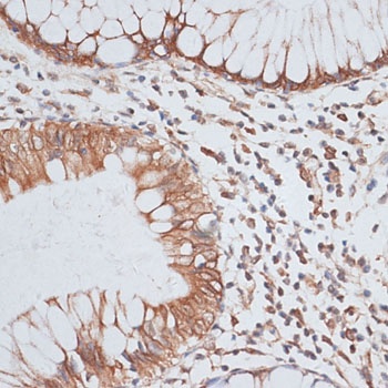 KIFC1 Antibody