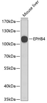 EPHB4 Antibody