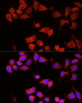 AAMP Antibody