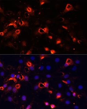 SMO Antibody