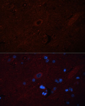 SOS1 Antibody