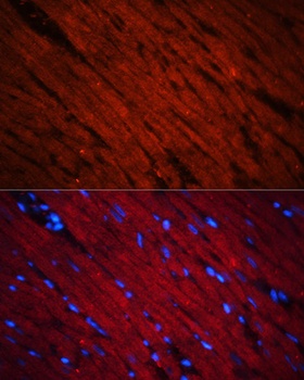 SOS1 Antibody