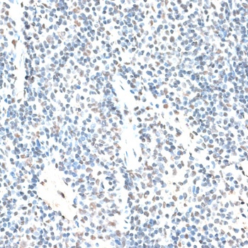 RBM17 Antibody