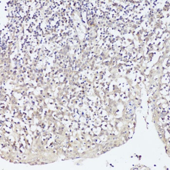 TWIST1 Antibody