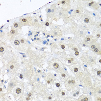 UBC Antibody