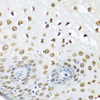 UBC Antibody