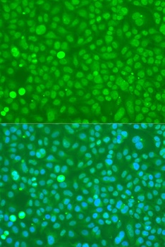 UBC Antibody