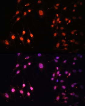 SETD2 Antibody